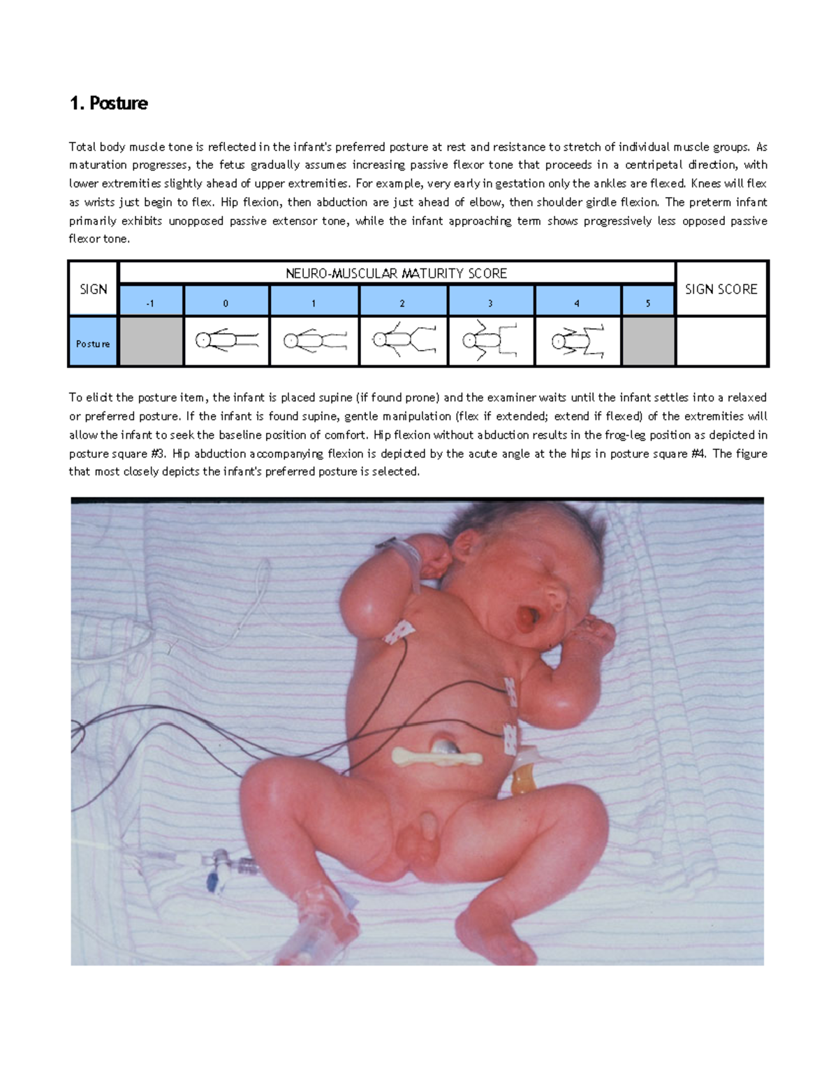 BALLARD SCORING FOR MATURITY ASSESSMENT OF INFANTS AFTER 24 HOURS Nursing Pysch Studocu BALLARD SCORING FOR MATURITY ASSESSMENT OF INFANTS AFTER 24 HOURS Nursing Pysch Studocu