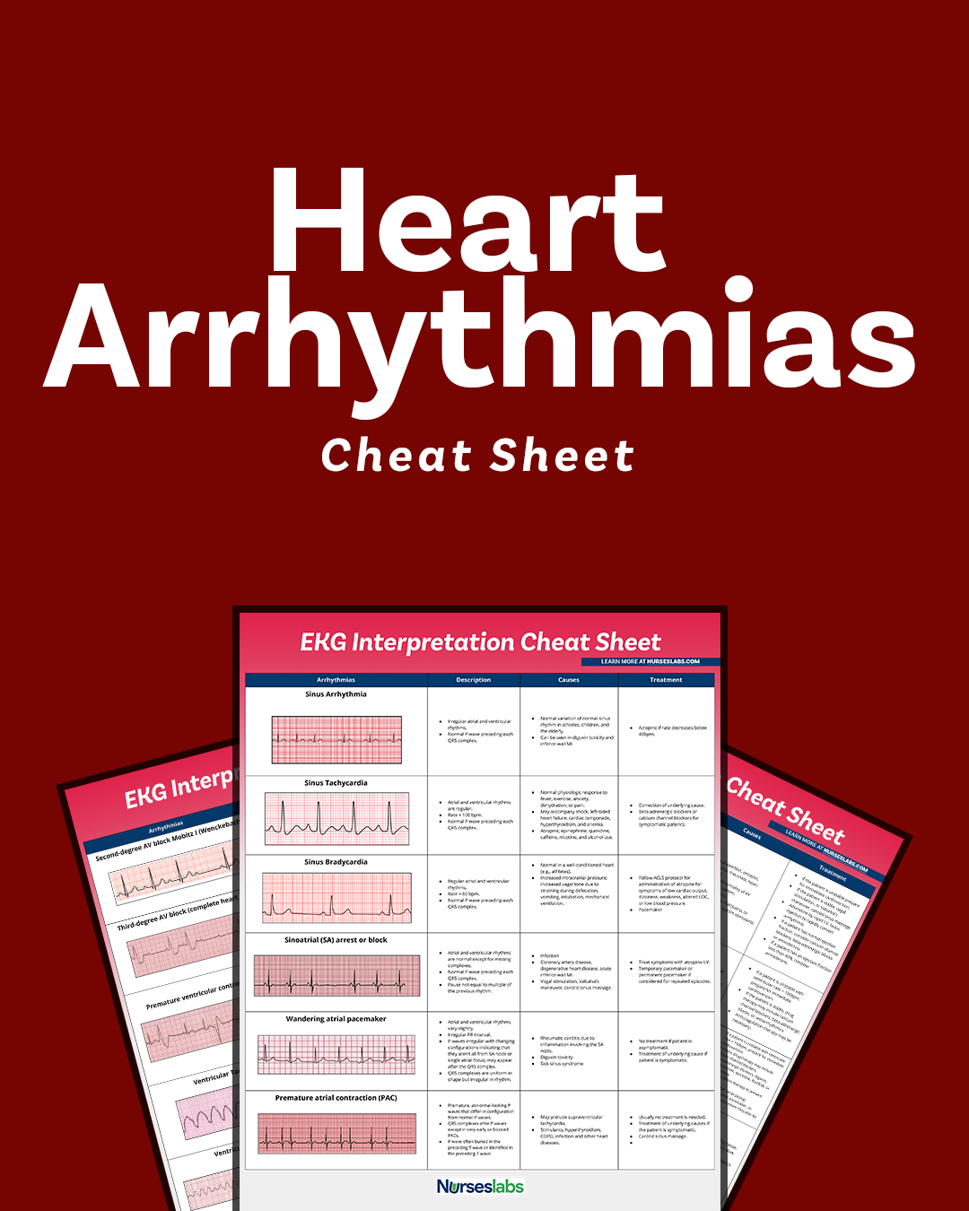 EKG Interpretation Cheat Sheet U0026 Heart Arrhythmias Guide 2020 Update EKG Interpretation Cheat Sheet U0026 Heart Arrhythmias Guide 2020 Update