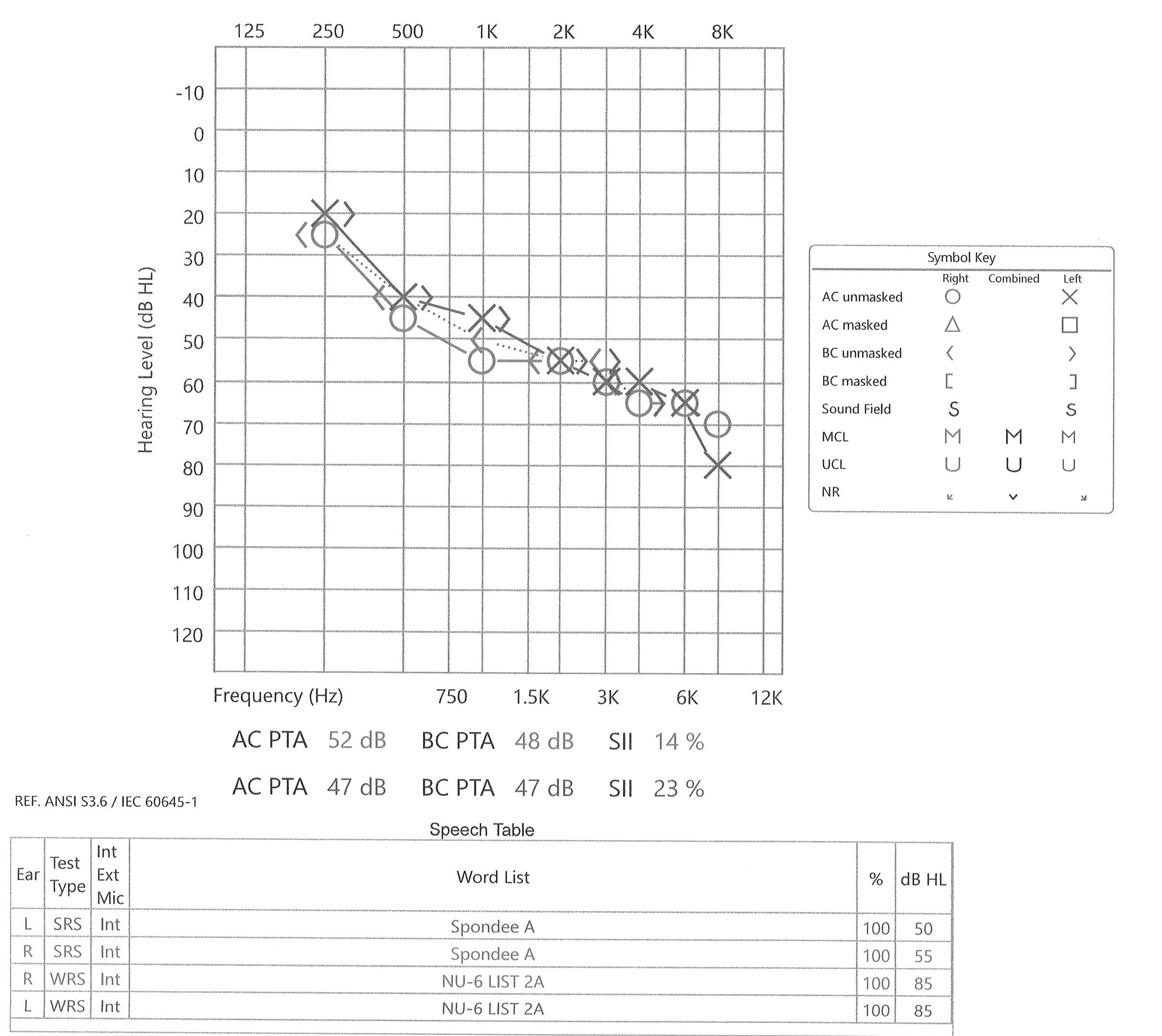 Hearing In Noise Test Score Sheet